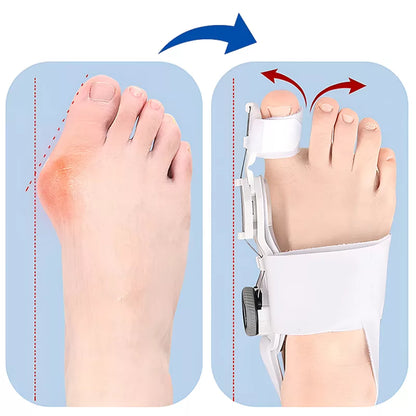 Adjustable Bunion Corrector Toe Straightener
