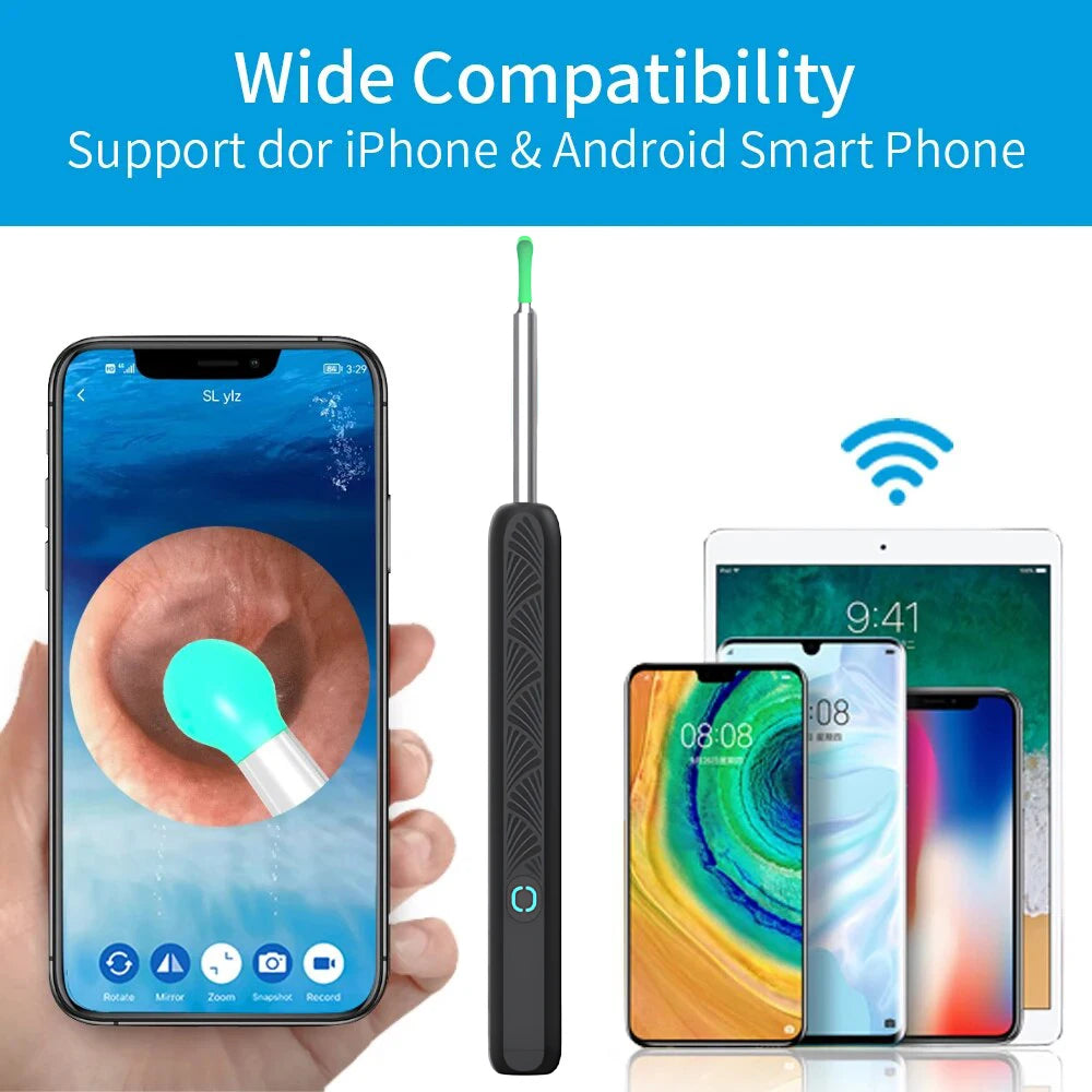 Wireless Ear Cleaner with 1296P Camera, USB-C Charging and WiFi